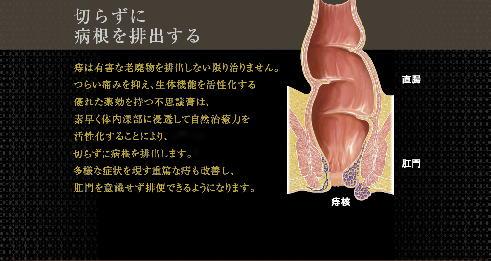 切らずに病根を排出する痔は有害な老廃物を排出しない限り治りません。つらい痛みを抑え、生体機能を旺盛にする優れた薬効を持つ不思議膏は素早く体内深部に浸透。
手術では切ることができない病根を排出して、自然治癒力を活性化させ、多様な症状を現す重篤な痔も根本から治し、肛門を意識せず排便できるようになります。